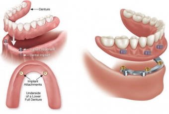 Đề án mở ngành Răng Hàm Mặt trình độ đại học